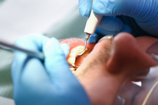 Best Emergency Gum Treatment in Marble Falls, TX