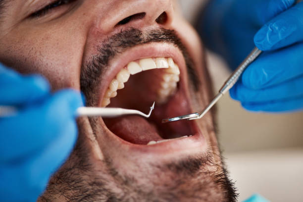 Best Emergency Treatment for Dental Infections or Abscesses in Marble Falls, TX